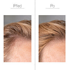 GS Merilin šampon pro ženy 40+, 250 ml