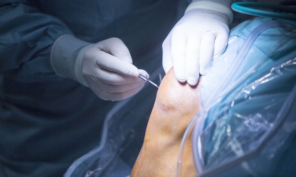 jak probíhá TEP kolene